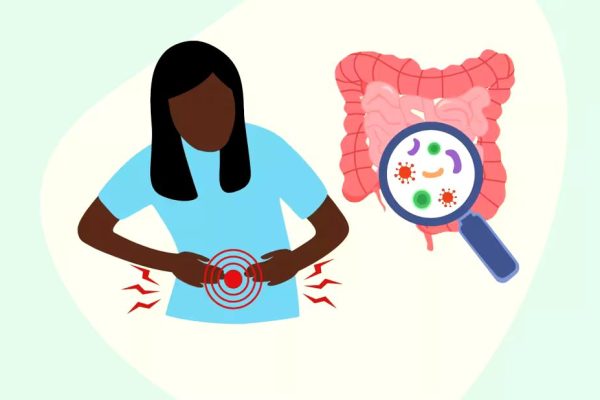 Five Food Poisoning Cases in Kavango, Four Dead