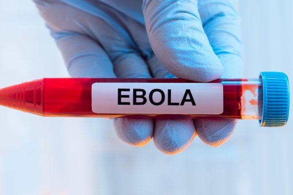 Africa needs $ 1.4 Billion to End Ebola 